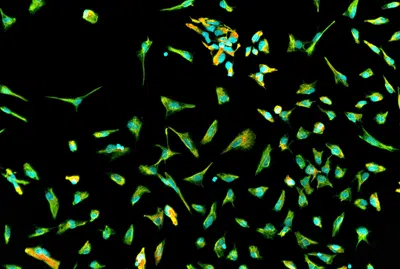 neural precursor cells immunocytochemistry icc