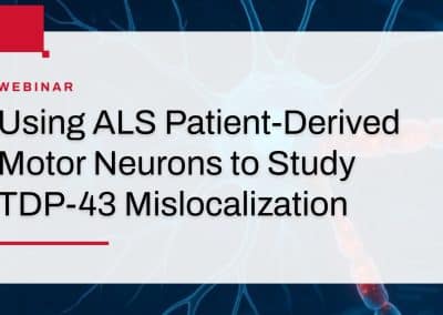 Using ALS Patient-Derived Motor Neurons to Study TDP-43 Mislocalization
