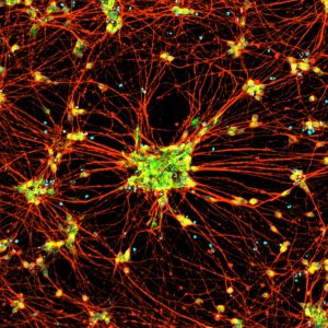 CH SeV ICC Immunocytochemistry