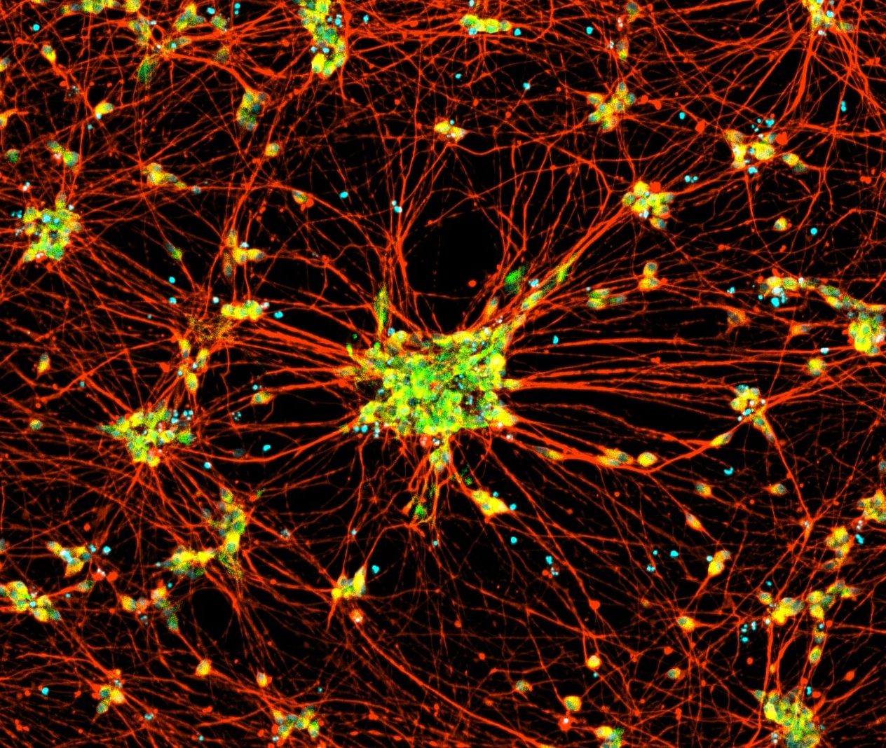 CH SeV ICC Immunocytochemistry