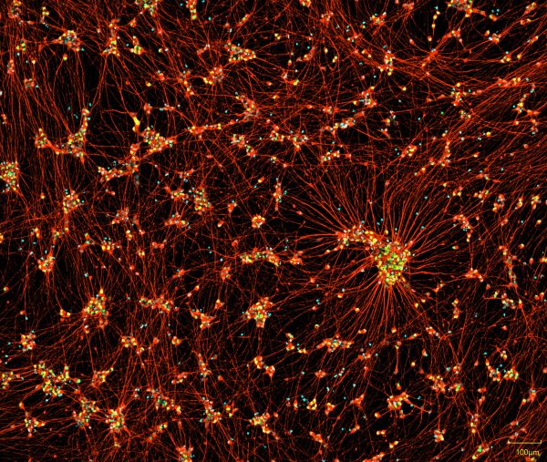 motor neurons SeV icc product image