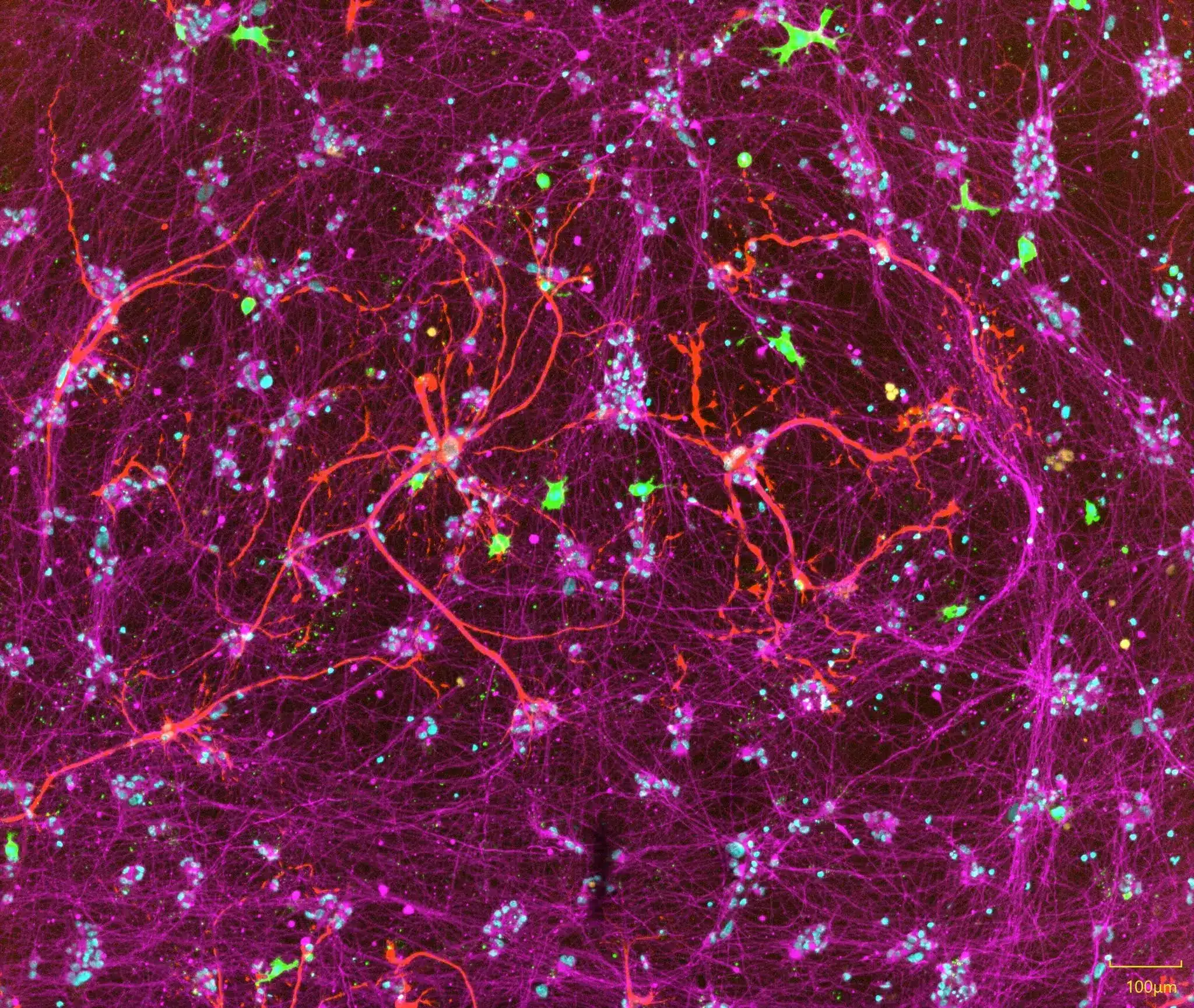 Custom iPSC Differentiation