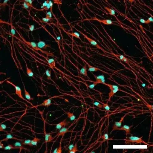 Amyotrophic Lateral Sclerosis (ALS) | Ricoh Biosciences