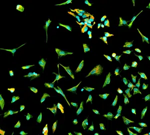 neural precursor cells immunocytochemistry icc