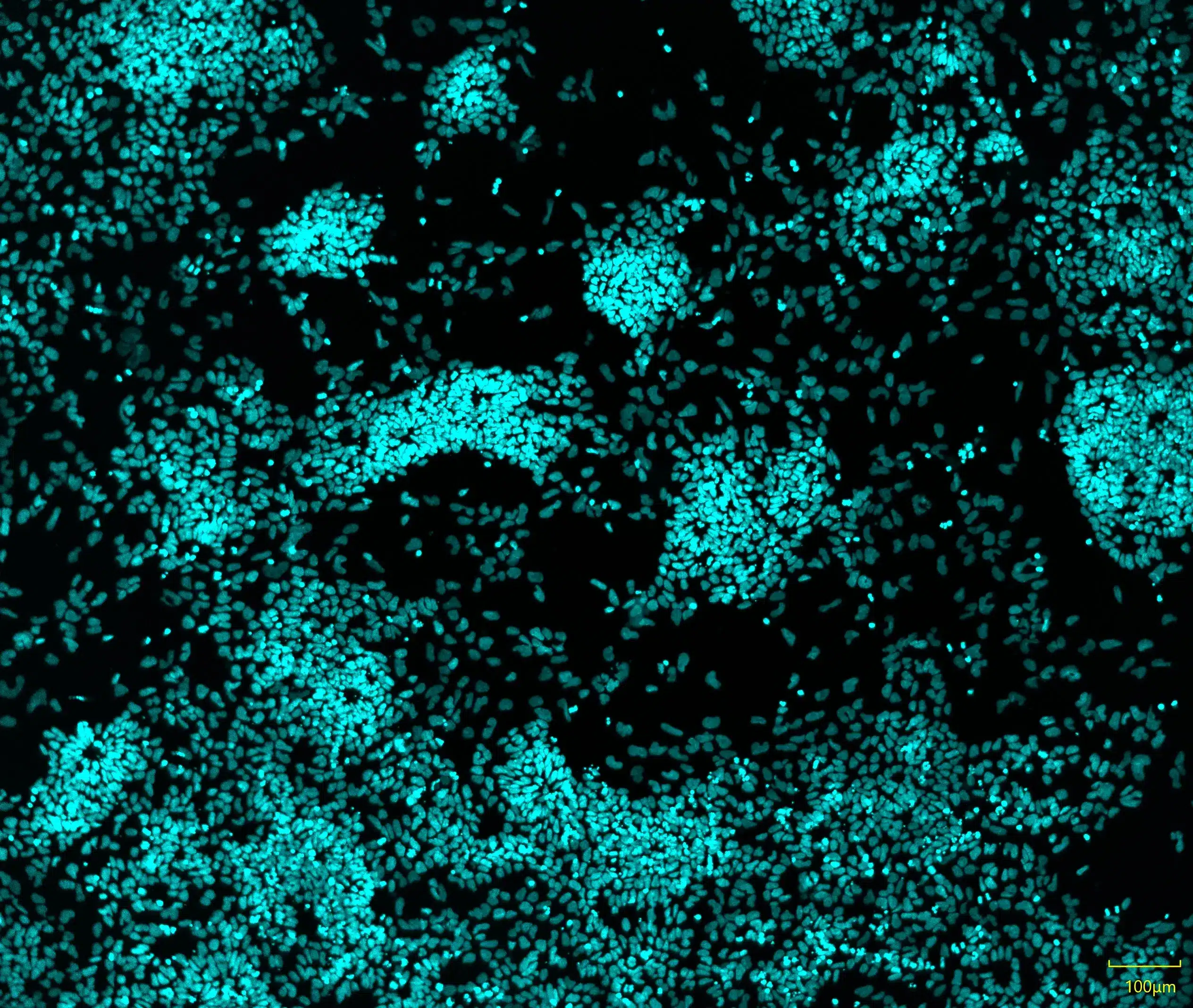 Neuron Subtype Quantification Icc Quick-Neuron™ Precursor - iPSC-Derived Neural Precursor Cells