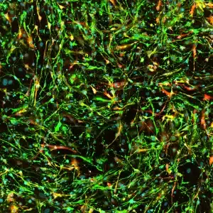 quick glia ipsc derived astrocytes gfap aldh1l1