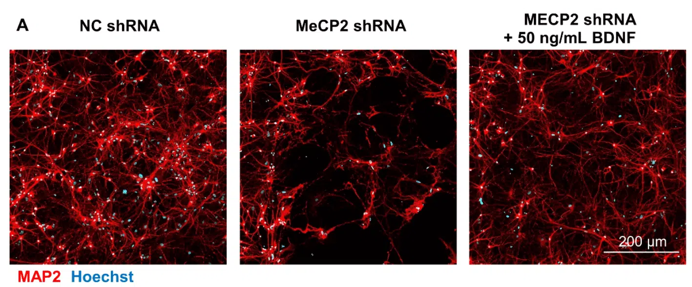Elixirgen Scientific Launches Proprietary In Vitro Assay Service Designed for Rett Syndrome
