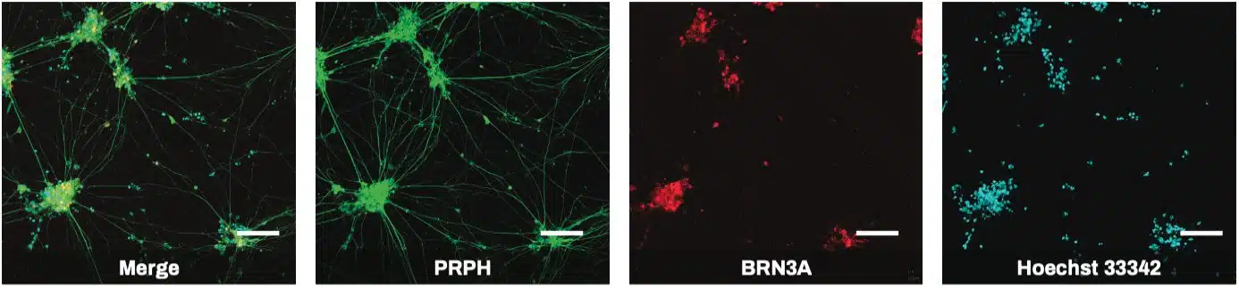 Neuron Subtype Quantification Icc Quick-Neuron™ Sensory - iPSC-Derived Sensory Neurons